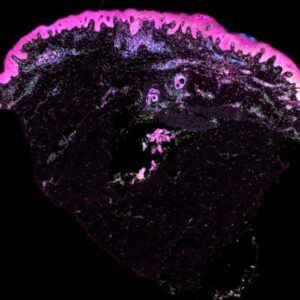 Noda Segmentasi Sel Kulit Manusia