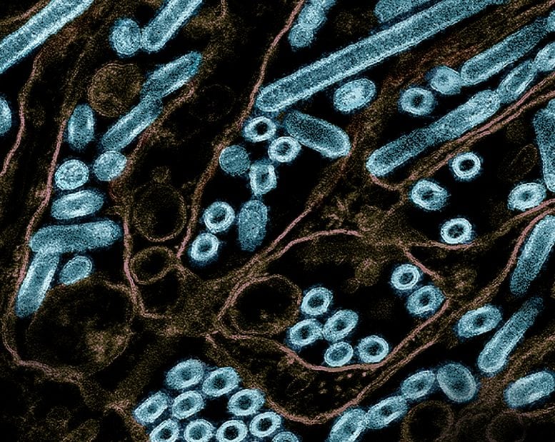 Partikel Virus H5N1