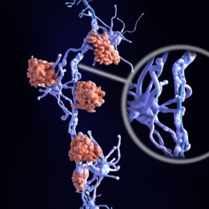 Neuron Sklerosis Multipel