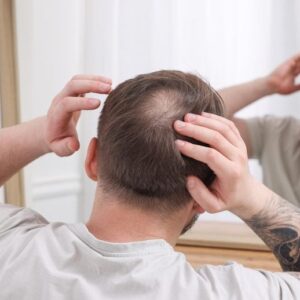 Cermin Pemeriksaan Rambut Rontok Pria Kebotakan