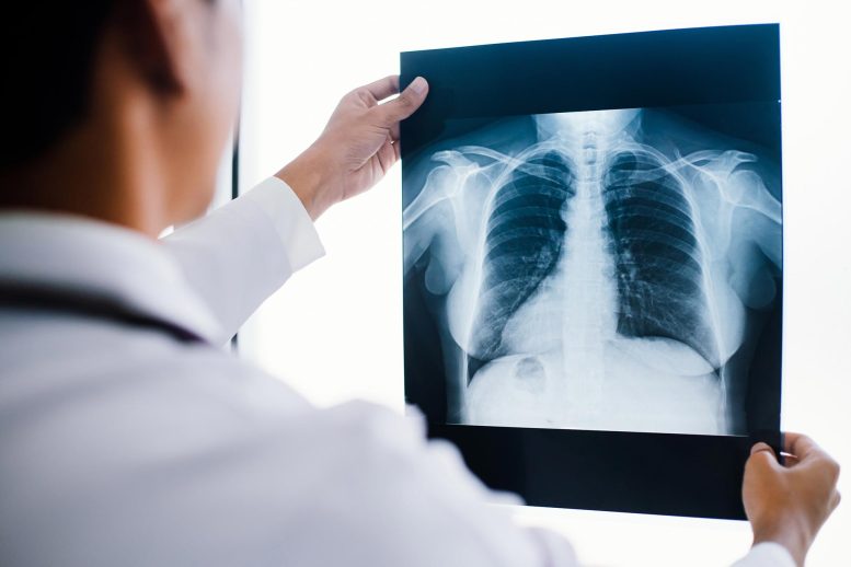 Dokter Memeriksa Rontgen Dada