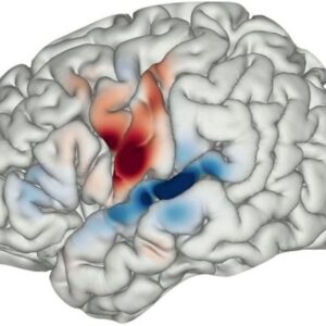 Pemetaan Otak Meningkatkan Pemahaman tentang Ucapan & Halusinasi Manusia pada Skizofrenia