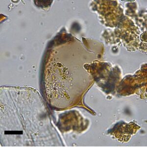 Telur Schistosoma mansoni