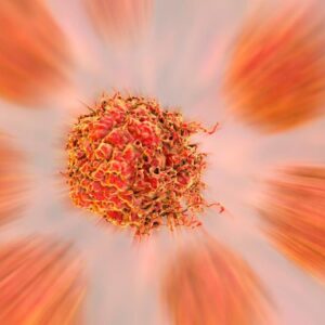 Ilustrasi Sel Kanker Prostat