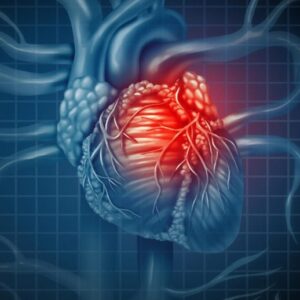 Konsep Penyakit Jantung