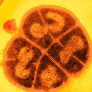 Conan si Bakteri (Deinococcus radiodurans)