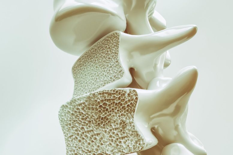 Osteoporosis di Tulang Belakang