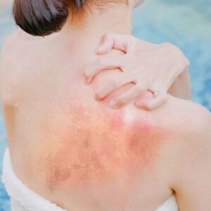 Kolam Terbakar Sinar Matahari