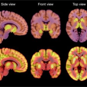 Anoreksia dan jumlah reseptor opioid