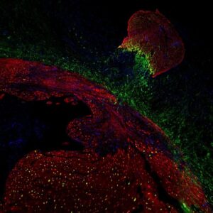 Regenerasi Jantung Dari Ikan Zebra Menjadi Tikus