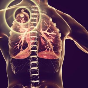 Pengobatan dan pencegahan tuberkulosis