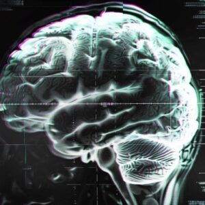 Konsep gangguan gangguan otak