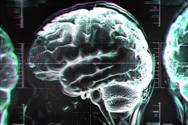 Konsep gangguan gangguan otak