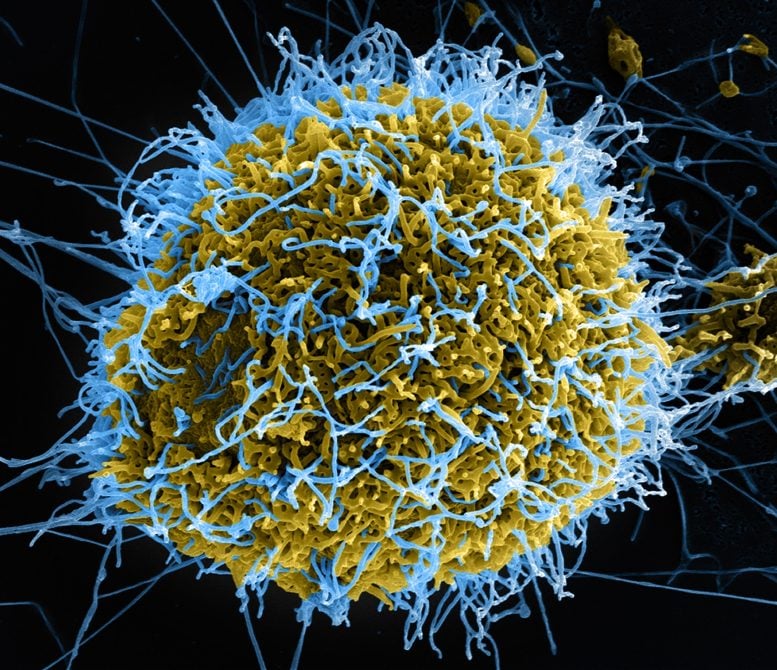 Ebola Virus Partikel Sem Niaid