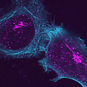 Sel manusia bersiap untuk melepaskan molekul pertempuran infeksi yang disebut sitokin