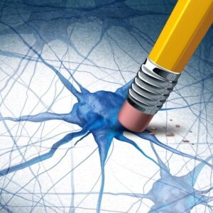 Konsep Penyakit Otak Demensia Alzheimer