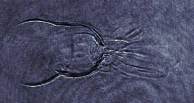 Plasma Shadowgraphy