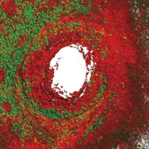 Neutrofil mengelilingi luka dan menghasilkan cincin kolagen