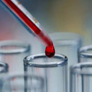 Sains Lab Tabung Tes Cairan Merah Darah