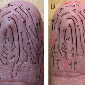 Pola kerutan bernomor menunjukkan konsistensi tinggi dari waktu ke waktu meskipun variasi kecil