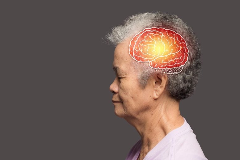 Demensia wanita senior Asia