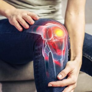 Wanita muda lutut sendi nyeri artritis