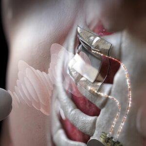 Pengisian daya baterai nirkabel menggunakan USG