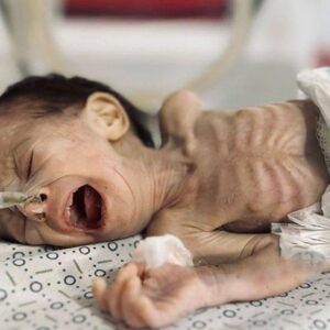 Gadis muda Palestina kelaparan sampai mati di Gaza