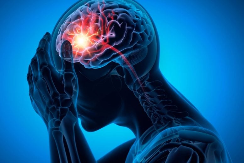 Pria dengan sakit kepala stroke otak