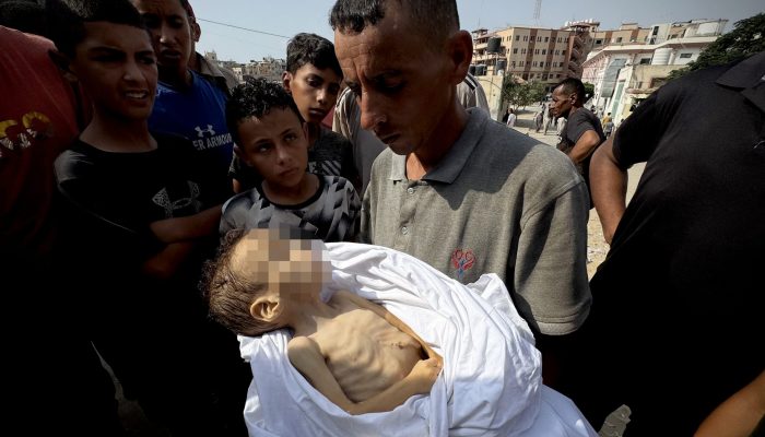 Kelaparan membunuh anak Gaza yang lain meningkatkan jumlah kematian kelaparan menjadi 227