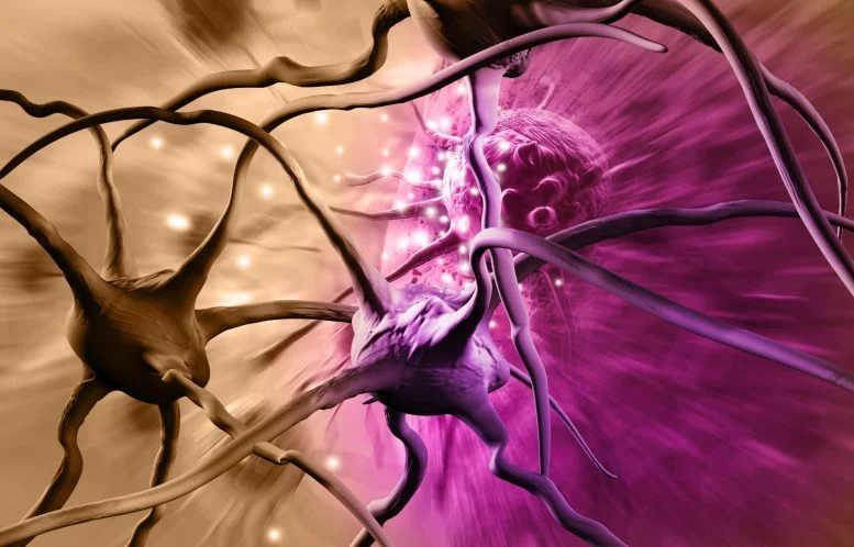 Neuron Sel Kanker Otak