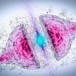 Degenerasi Sinapsis Demensia Parkinson Alzheimer