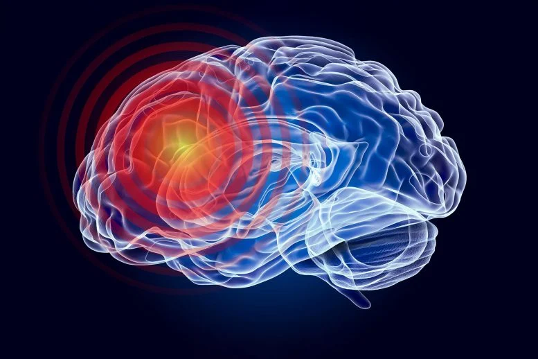 Penggambaran Anatomi Kerusakan Otak