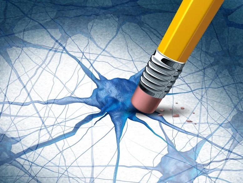 Konsep Penyakit Otak Demensia Alzheimer