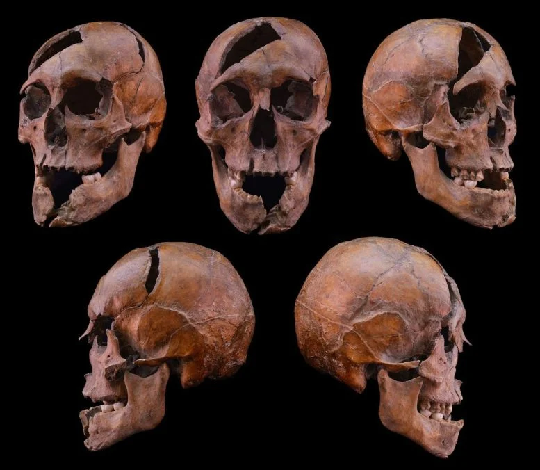 Duke Béla Skull