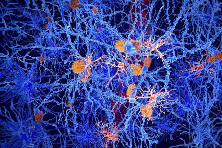 Sel Mikroglia Otak Neuroscience Penyakit Alzheimer