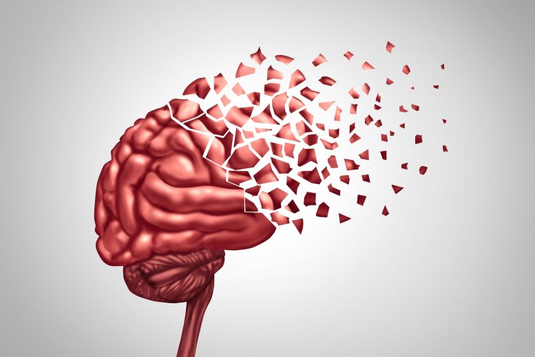 Kehilangan Memori Penyakit Otak Demensia Alzheimer