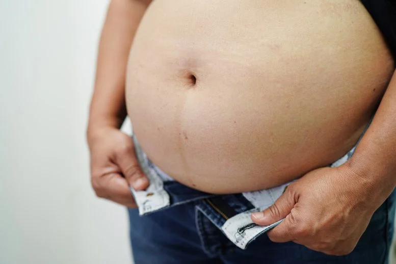 Obesitas Wanita Perut Gemuk